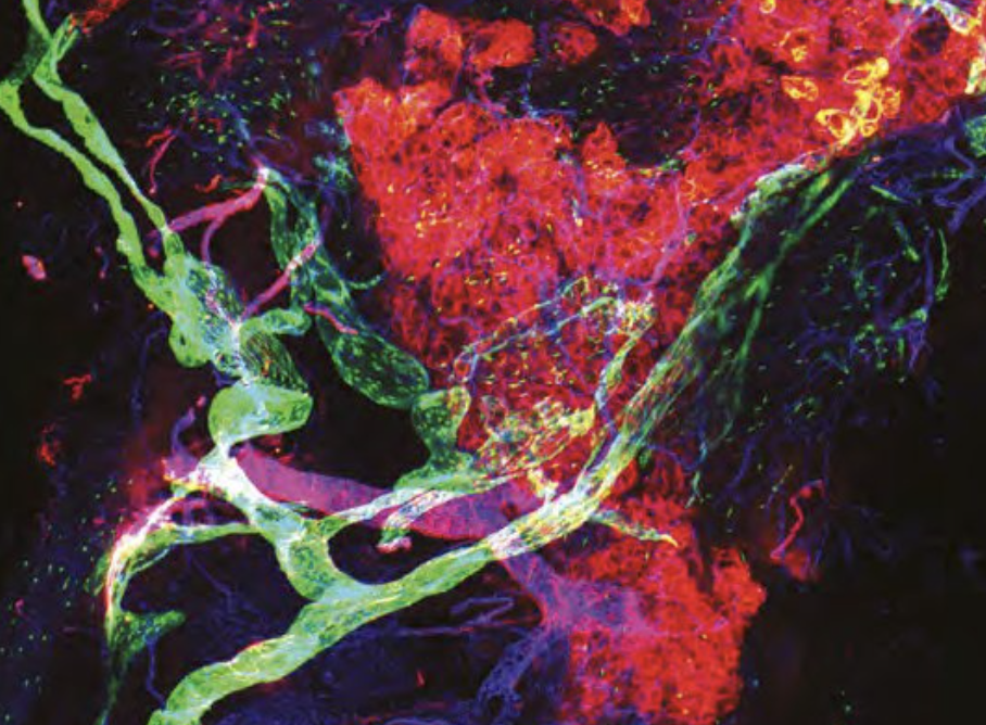 Augmentation du drainage du LCR par stimulation non invasive des lymphatiques cervicaux 